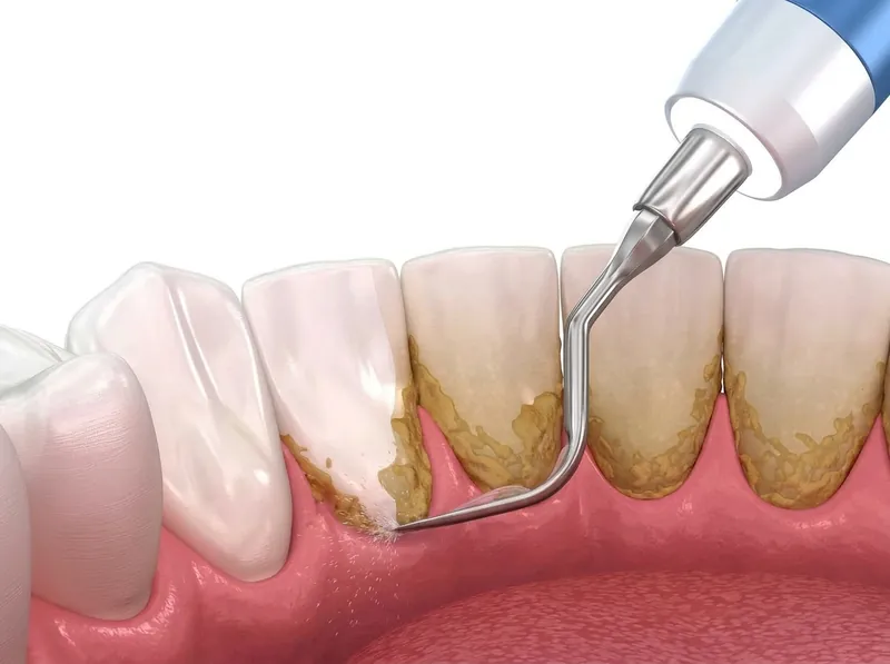 General Dentistry
