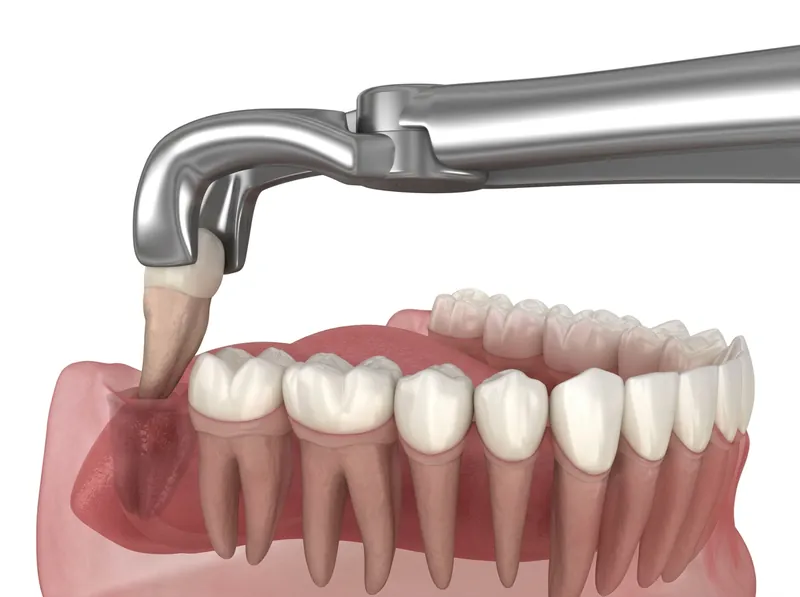 Oral Surgery