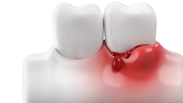 Periodontics