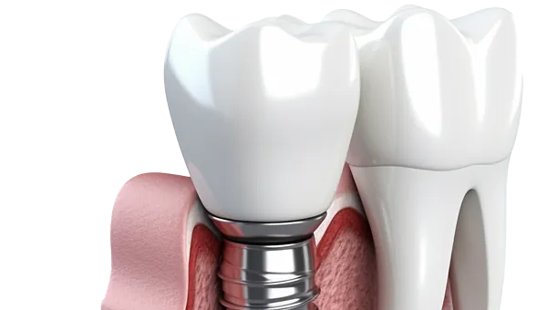 Implantology