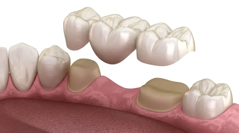 Prosthodontics